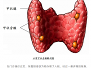 肾衰患者因骨痛坐轮椅入院，出院时竟能行动自如