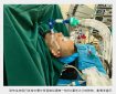 【医学视界】不用插管也能做手术？重庆市人民医院微创技术再升级，成功切除胸腺囊肿